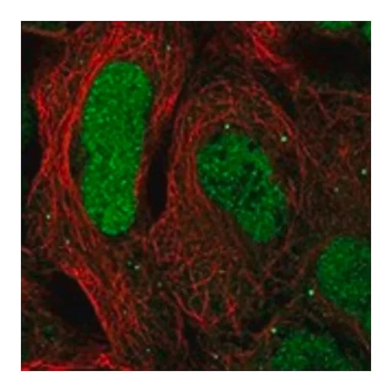 Merck Anti-CAMTA2 antibody produced in rabbit