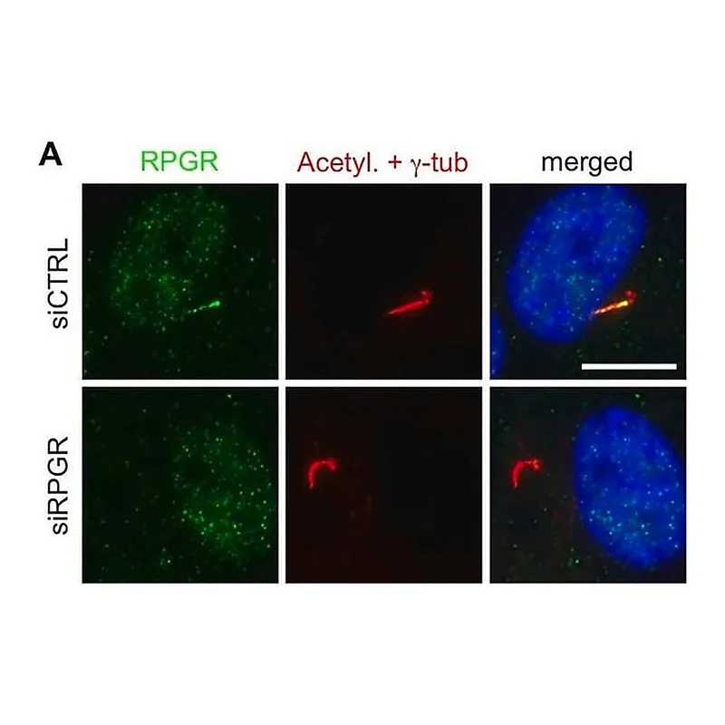 Merck Anti-RPGR antibody produced in rabbit