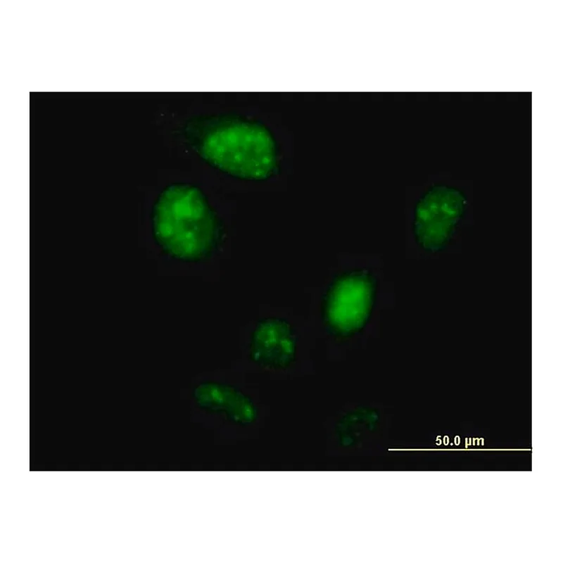 Merck Anti-ZNF738 antibody produced in mouse