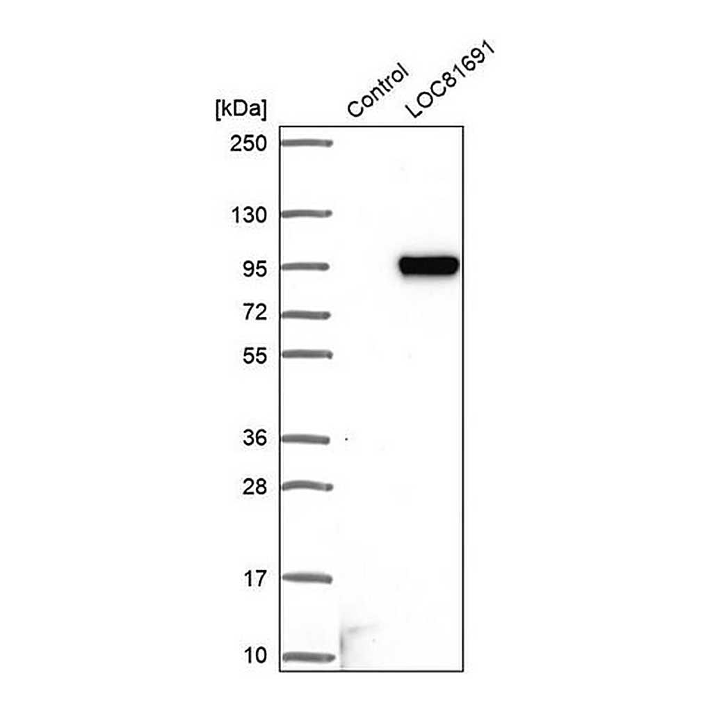 Merck Anti-AC004381.6 antibody produced in rabbit