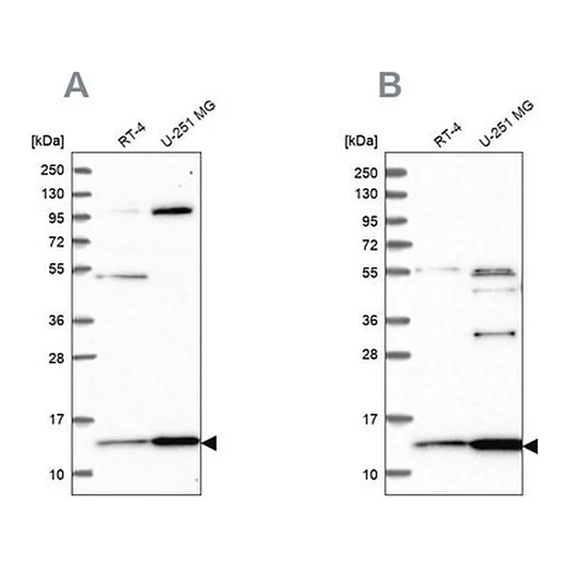 Merck Anti-TRMT112 antibody produced in rabbit