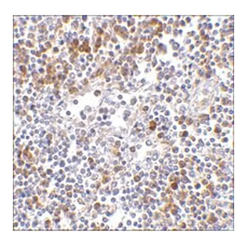 Merck ANTI-MDA5