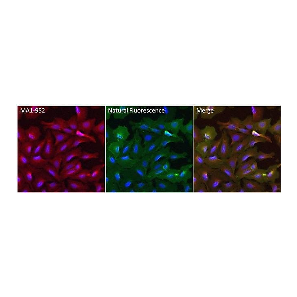Thermo Fisher Scientific Goat anti-Mouse IgG (H+L) Secondary Antibody, DyLight 550
