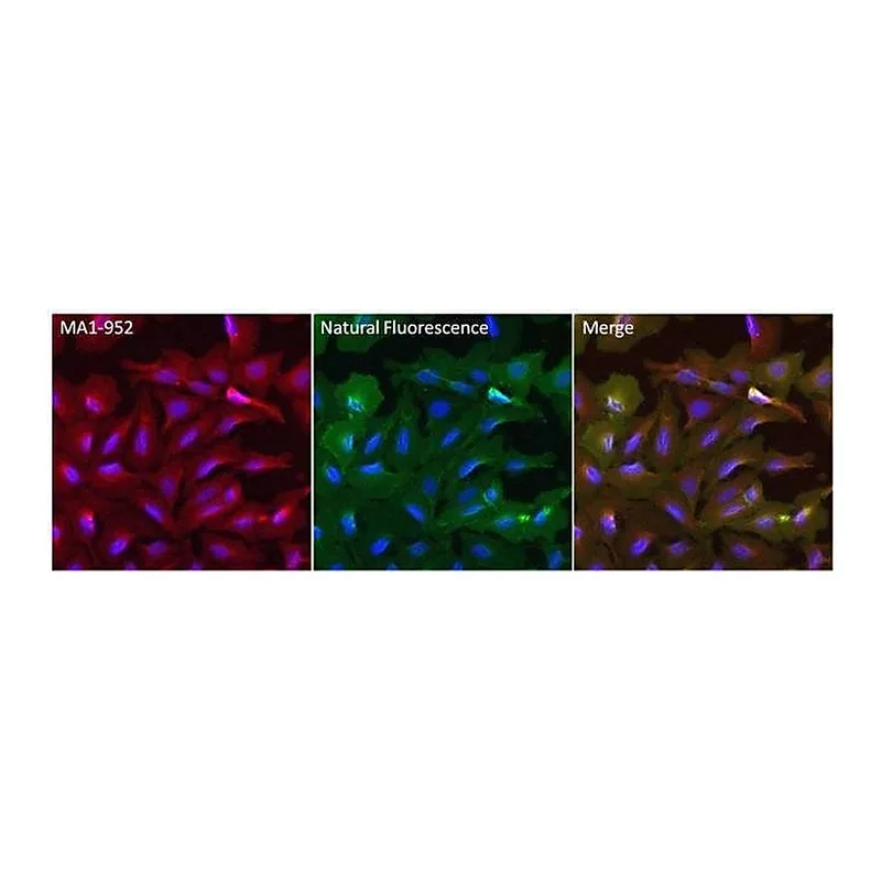 Thermo Fisher Scientific Goat anti-Mouse IgG (H+L) Secondary Antibody, DyLight 550