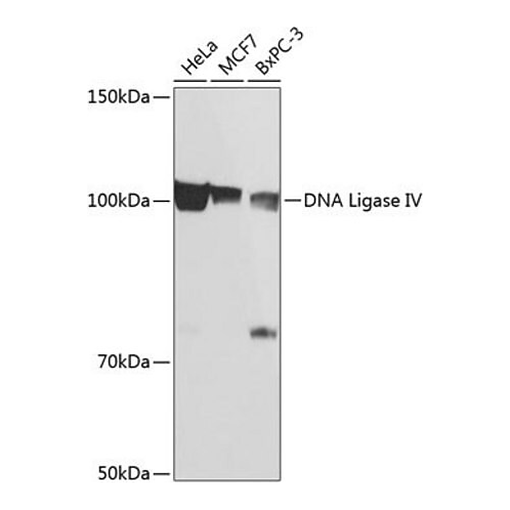 Merck Anti-DNA Ligase IV antibody produced in rabbit