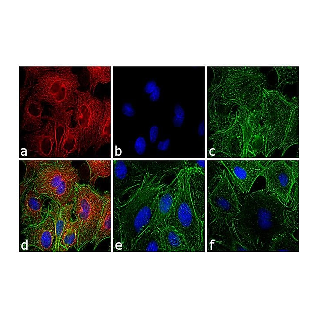Thermo Fisher Scientific Rabbit anti-Rat IgG (H+L) Secondary Antibody, TRITC