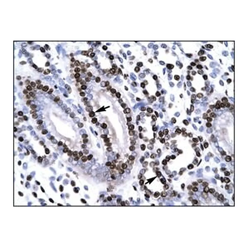 Merck Anti-NR2F6