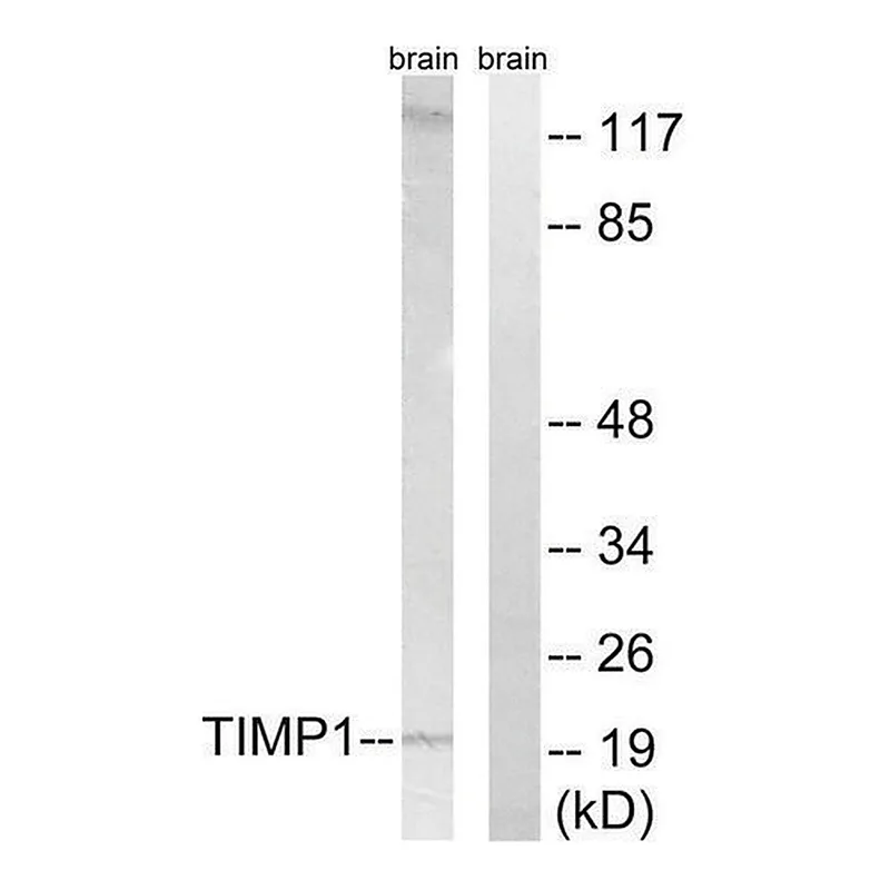 Merck Anti-TIMP1 antibody produced in rabbit
