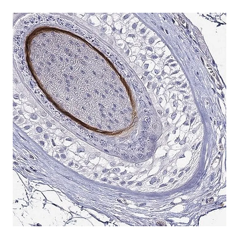 Merck Anti-KRT40 antibody produced in rabbit