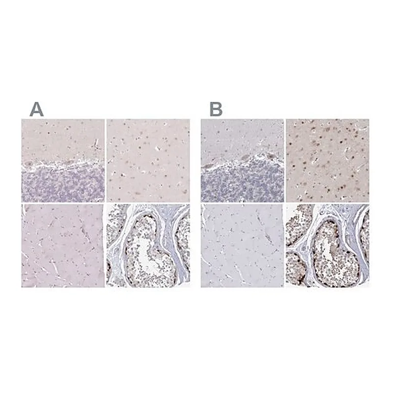 Merck Anti-USP11 antibody produced in rabbit