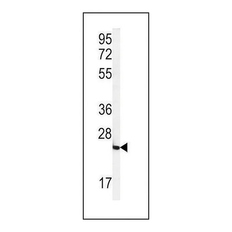 Merck ANTI-FOLR2(N-TERMINAL) antibody produced in rabbit