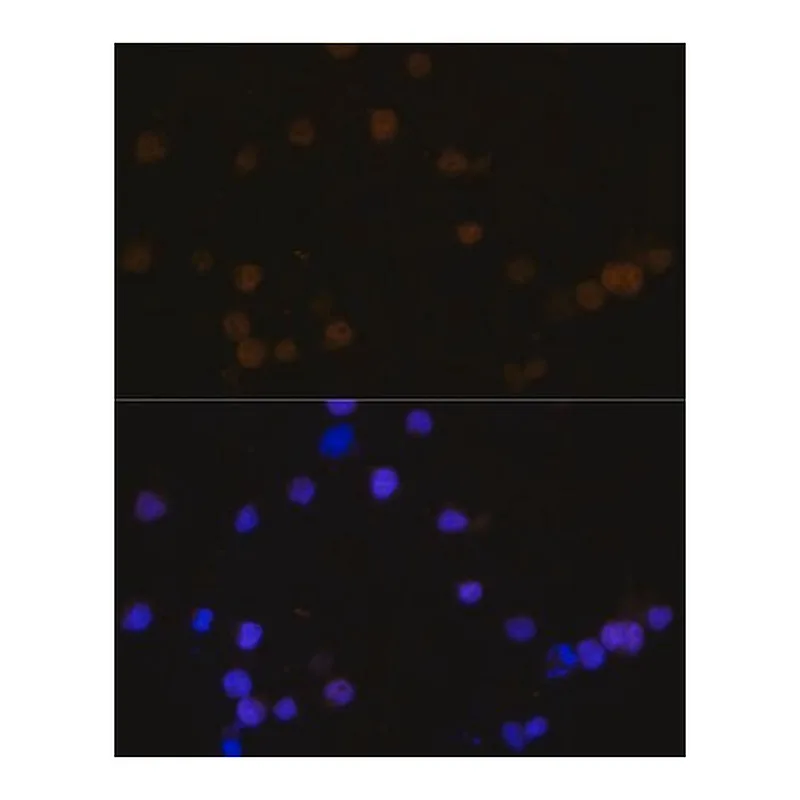 Merck Anti- RB antibody produced in rabbit