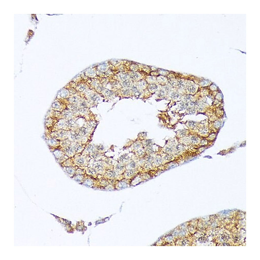 Merck Anti-Cortactin antibody produced in rabbit