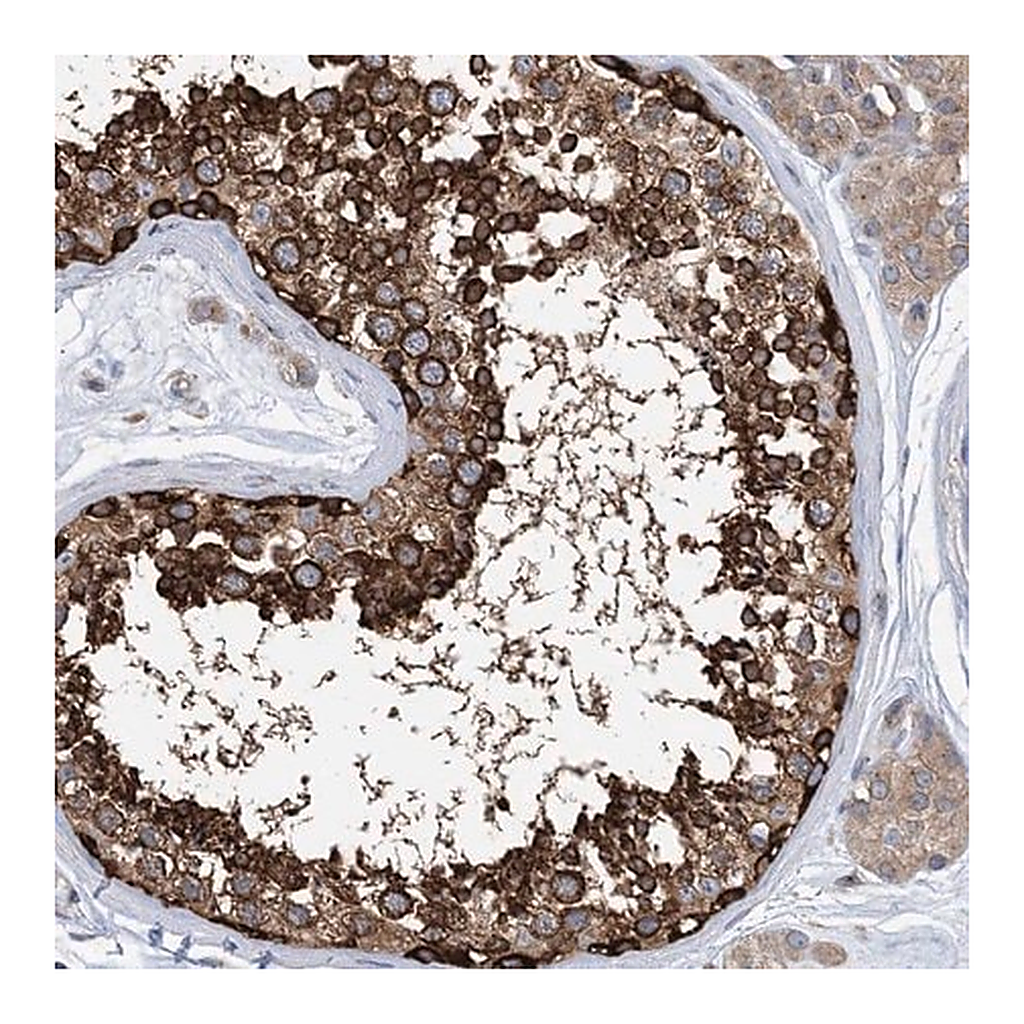 Merck Anti-DYNC1LI1 antibody produced in rabbit