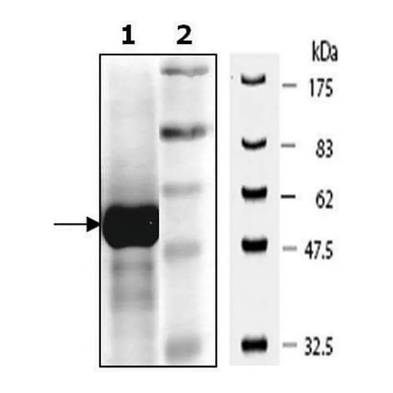 Merck PKM1 active human