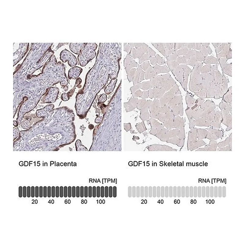 Merck Monoclonal Anti-GDF15 antibody produced in mouse