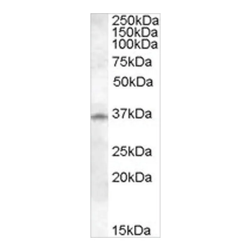 Merck Anti-Cathepsin K antibody produced in goat