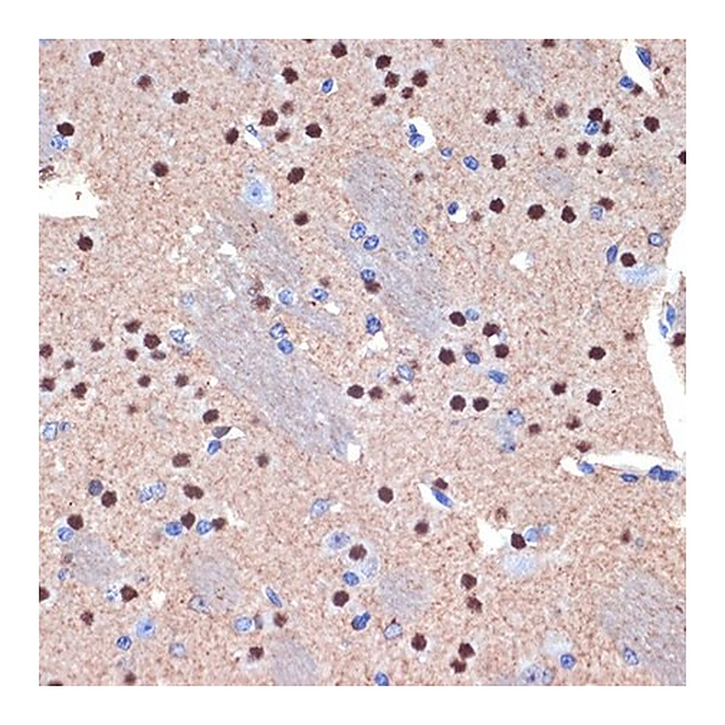 Merck Anti-CTIP2/BCL11B antibody produced in rabbit