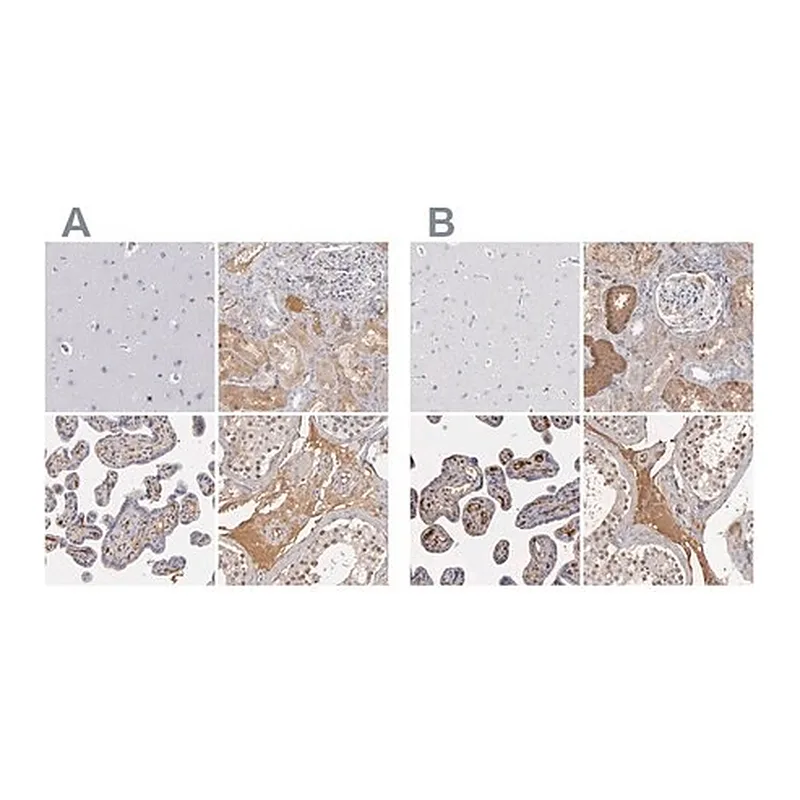 Merck Anti-SERPINA1 antibody produced in rabbit