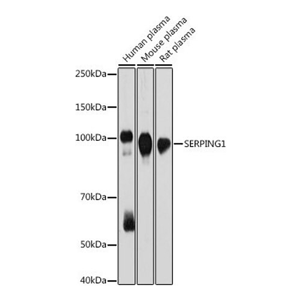 Merck Anti-SERPING1 antibody produced in rabbit