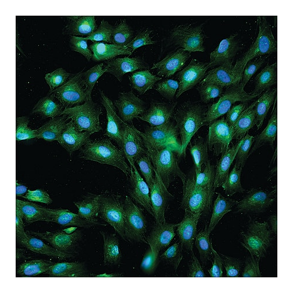 Merck Anti-Rabbit IgG (whole molecule)-FITC antibody produced in goat