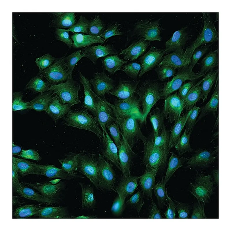 Merck Anti-Rabbit IgG (whole molecule)-FITC antibody produced in goat