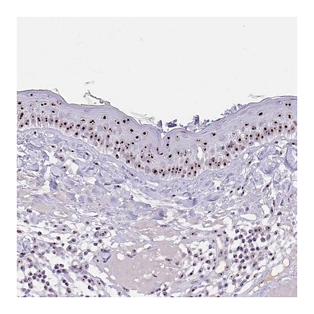 Merck Anti-PAX3 antibody produced in rabbit