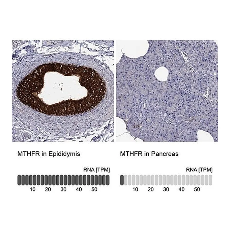 Merck Anti-MTHFR antibody produced in rabbit