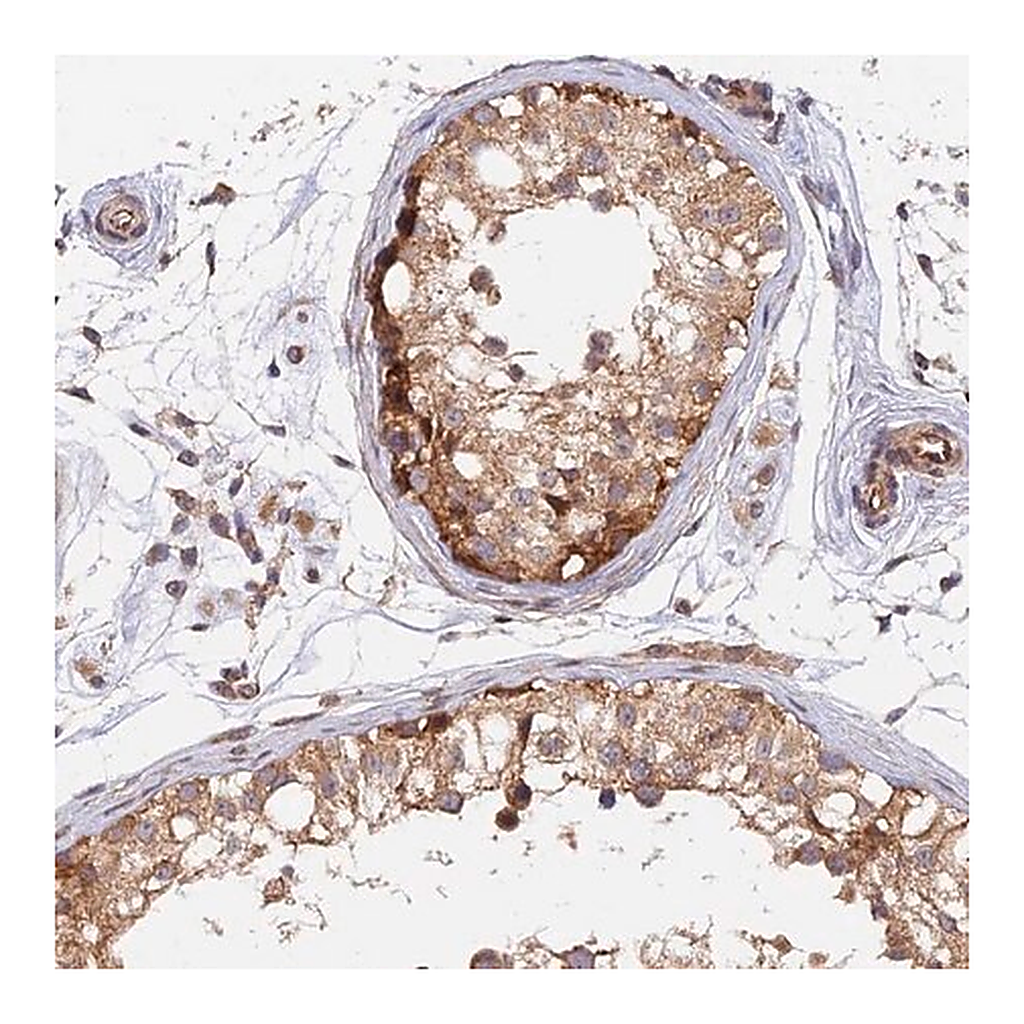 Merck Anti-WDR41 antibody produced in rabbit