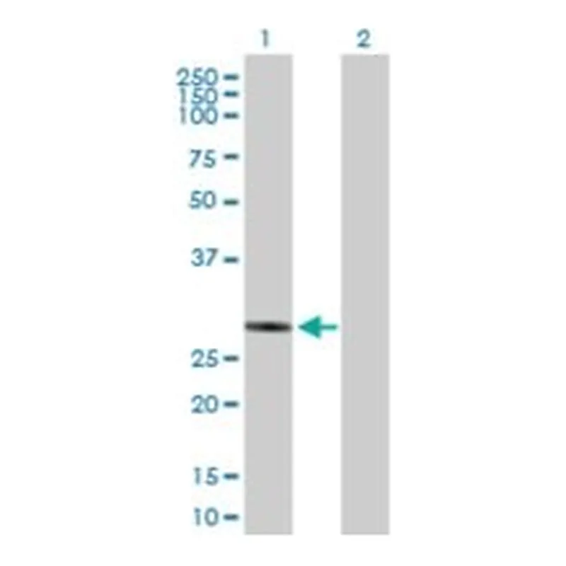 Merck ANTI-NUBPL