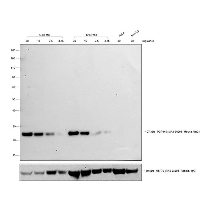 Thermo Fisher Scientific Donkey anti-Mouse IgG (H+L) Cross-Adsorbed Secondary Antibody, HRP