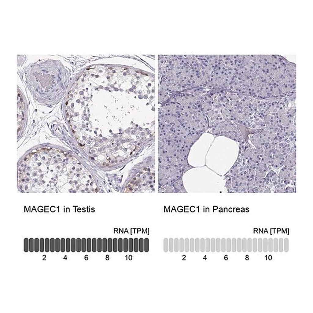 Merck Anti-MAGEC1 antibody produced in rabbit