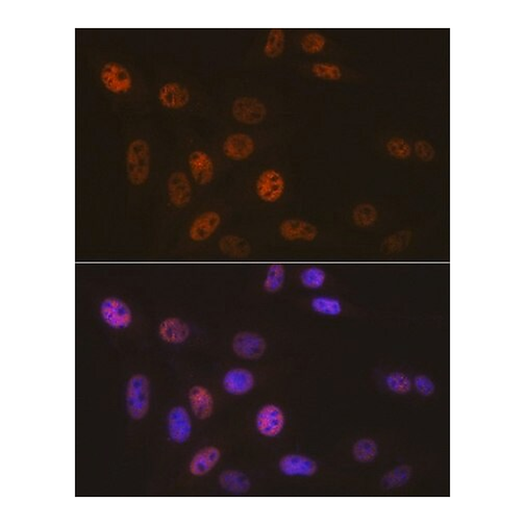 Merck Anti- SMARCB1/SNF5 antibody produced in rabbit