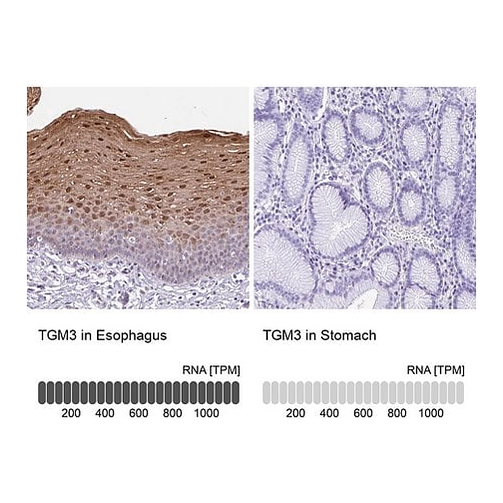 Merck Anti-TGM3 antibody produced in rabbit