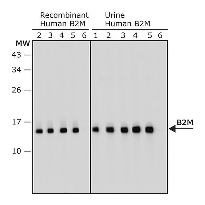 Merck Anti-B2M antibody, Mouse monoclonal