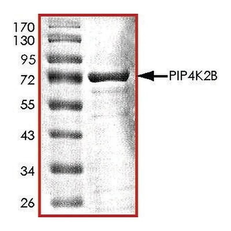 Merck PIP4K2B, ACTIVE