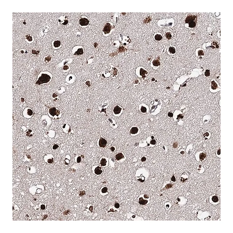 Merck Anti-MATR3 antibody produced in rabbit