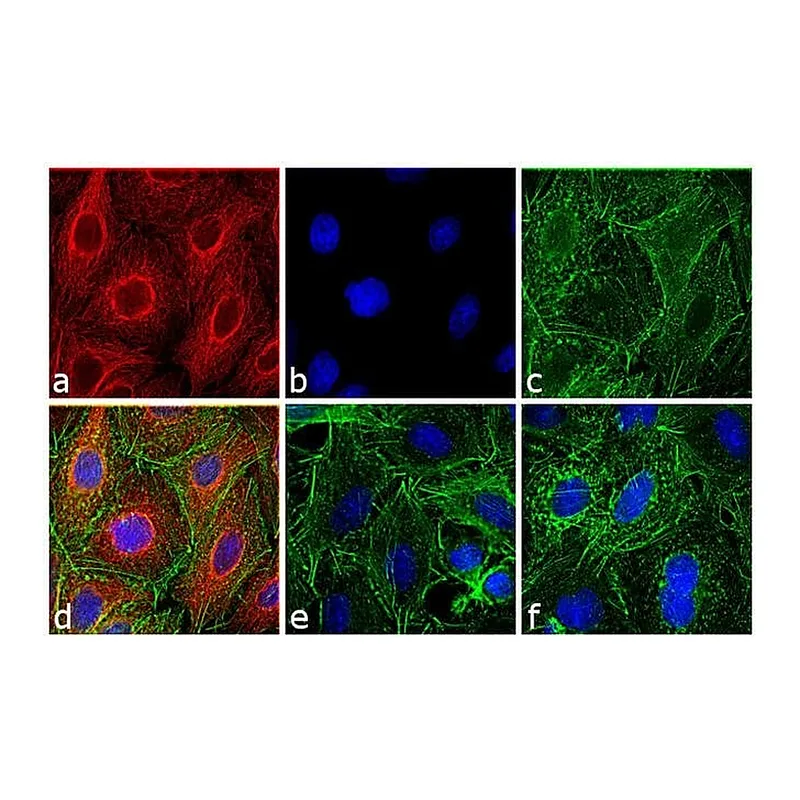 Thermo Fisher Scientific Goat anti-Rat IgG (H+L) Cross-Adsorbed Secondary Antibody, DyLight 594