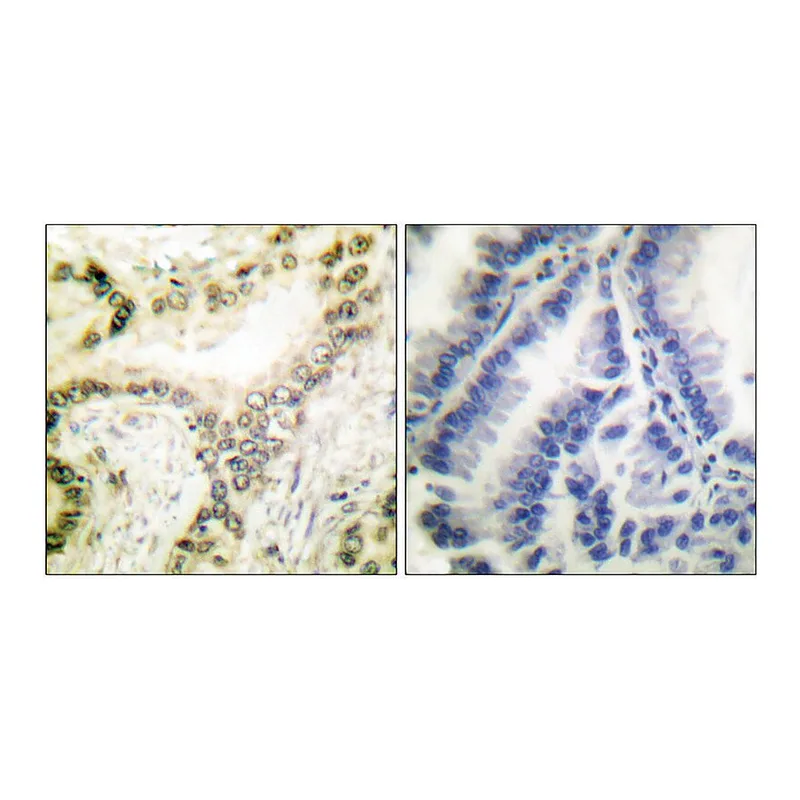Merck Anti-Histone H3 (Acetyl-Lys18) antibody produced in rabbit