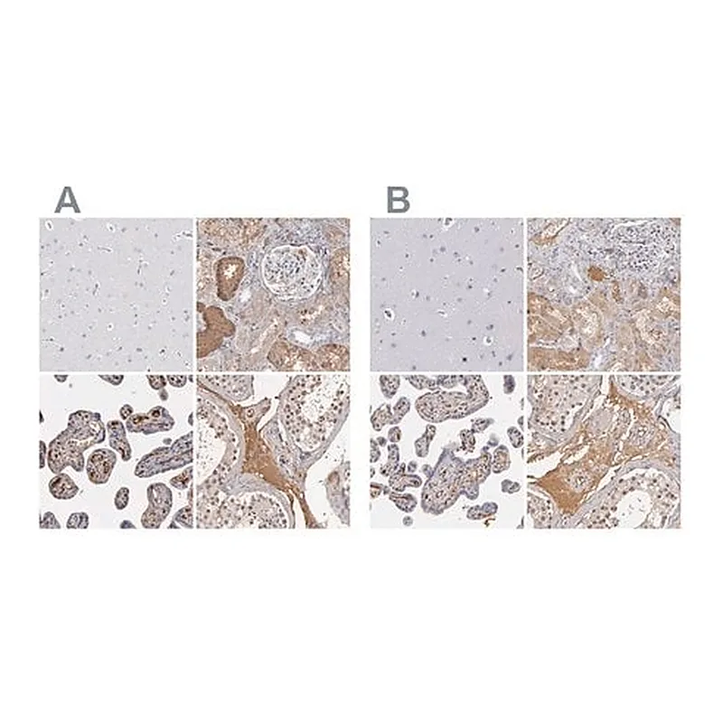 Merck Anti-SERPINA1 antibody produced in rabbit