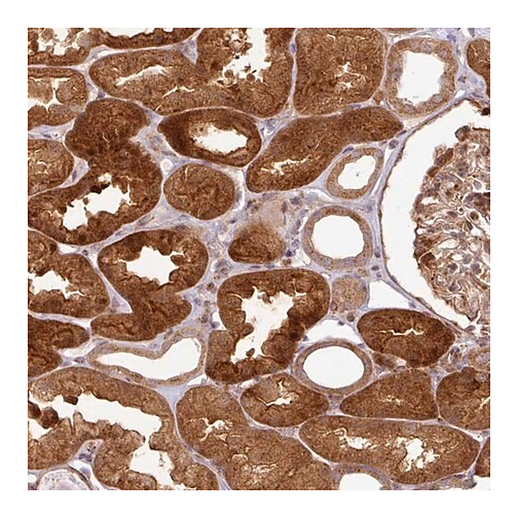 Merck Anti-ATAT1 antibody produced in rabbit