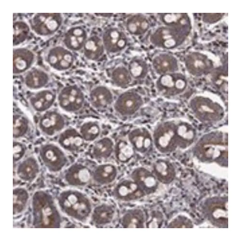 Merck Anti-RPLP0 antibody produced in rabbit