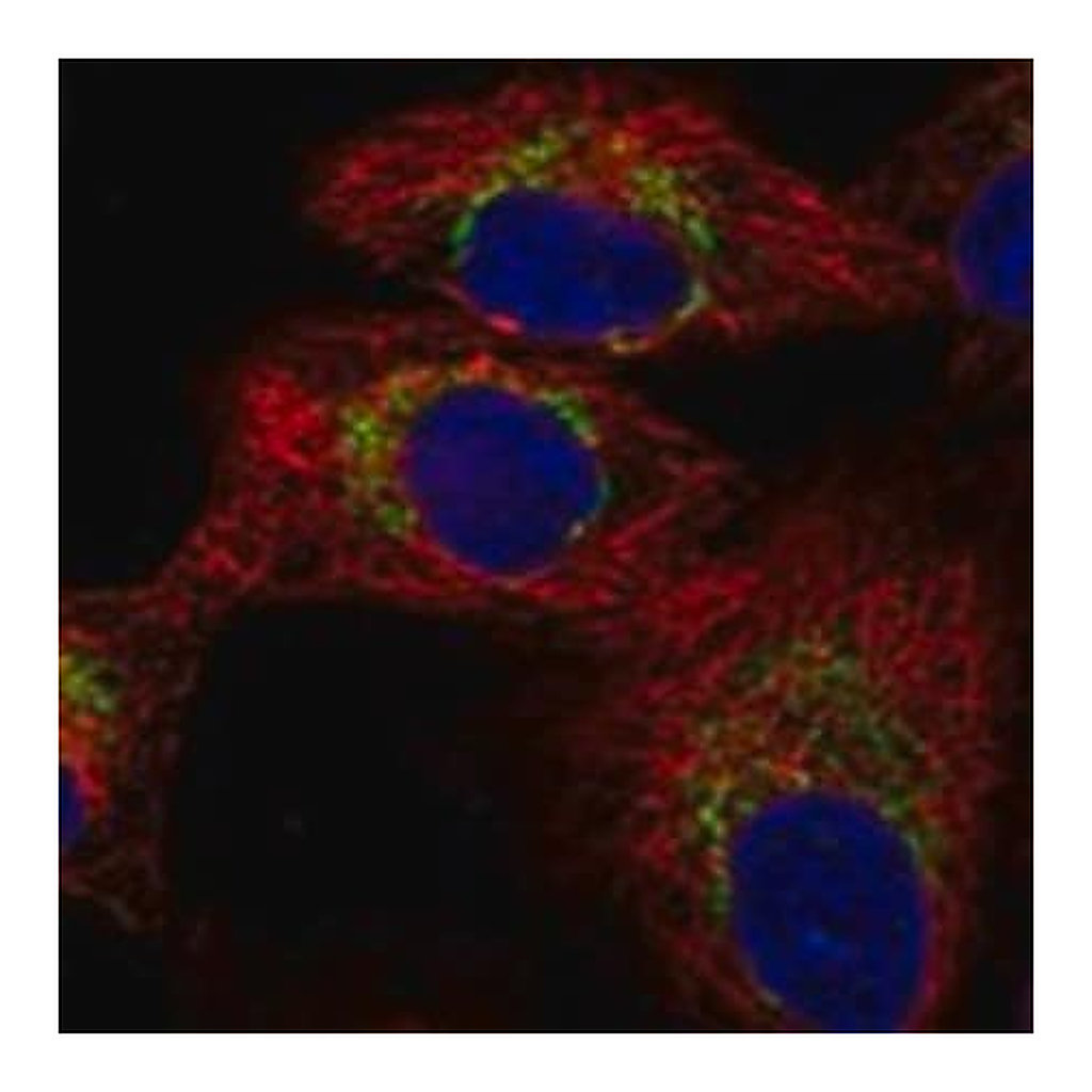 Merck Anti-TRMT61A antibody produced in rabbit