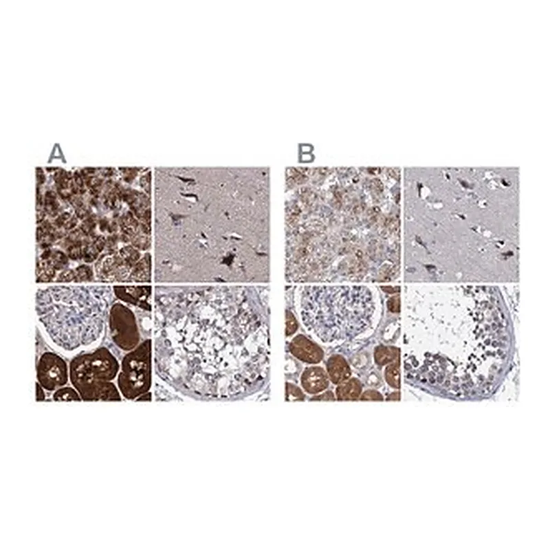 Merck ANTI-CLPB
