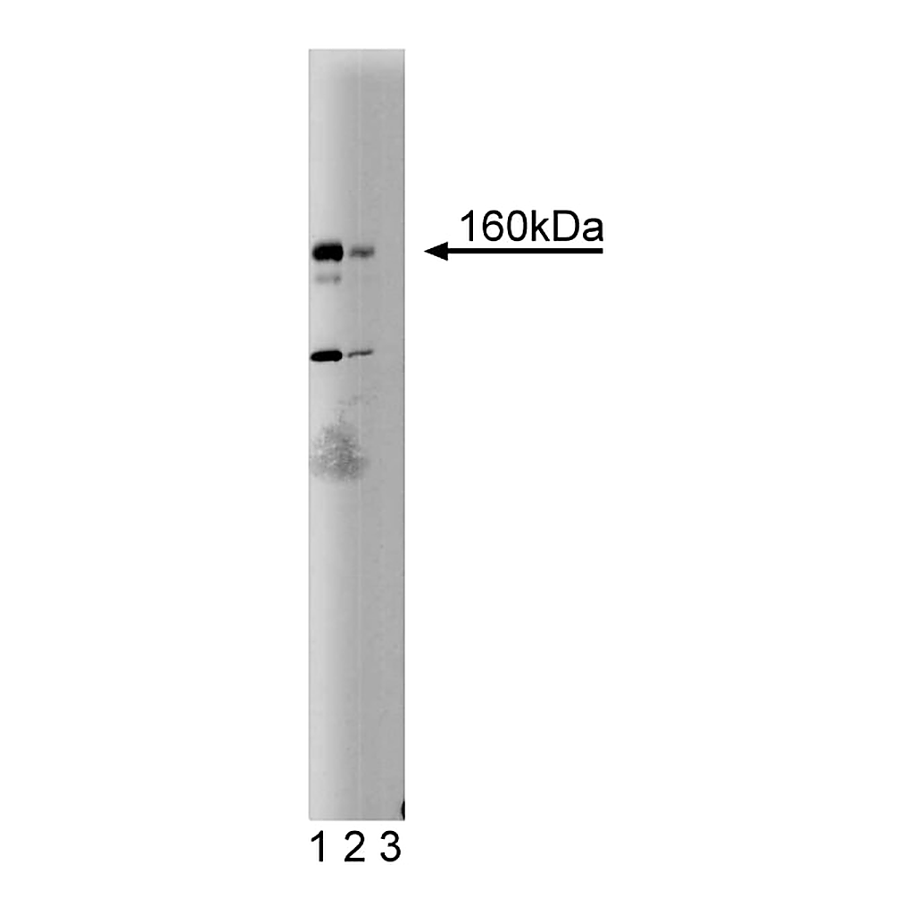 BD Purified Mouse Anti-Human DAP Kinase