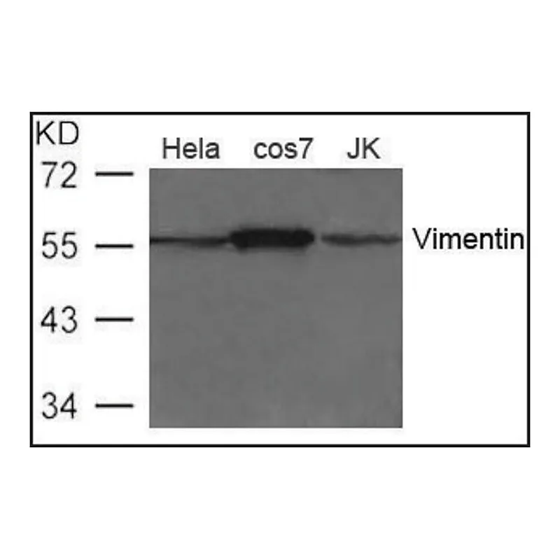 Merck Anti-Vimentin antibody produced in rabbit