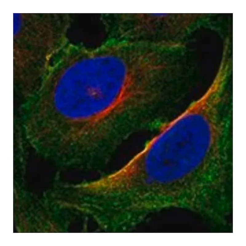 Merck Anti-PALM2AKAP2 antibody produced in rabbit