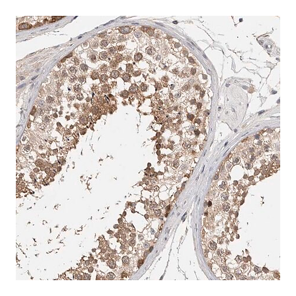 Merck Anti-CERS3 antibody produced in rabbit