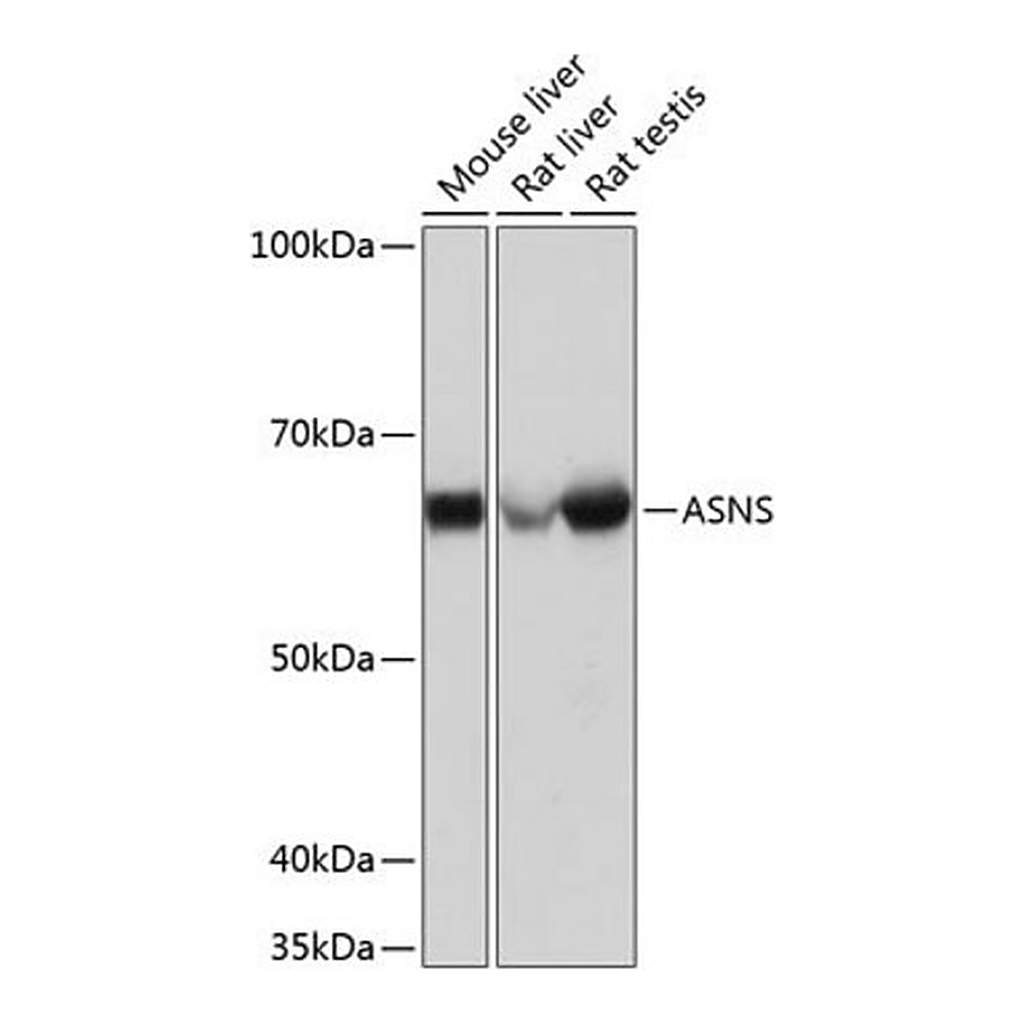 Merck Anti-ASNS antibody produced in rabbit