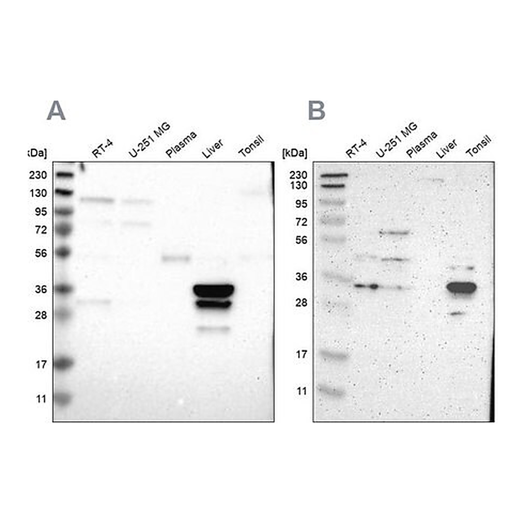 Merck Anti-PHYH antibody produced in rabbit